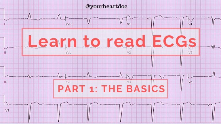 What you need to know when reading an ECG