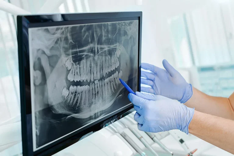 Dental X Rays: A Key Tool In General Dentistry Diagnostics